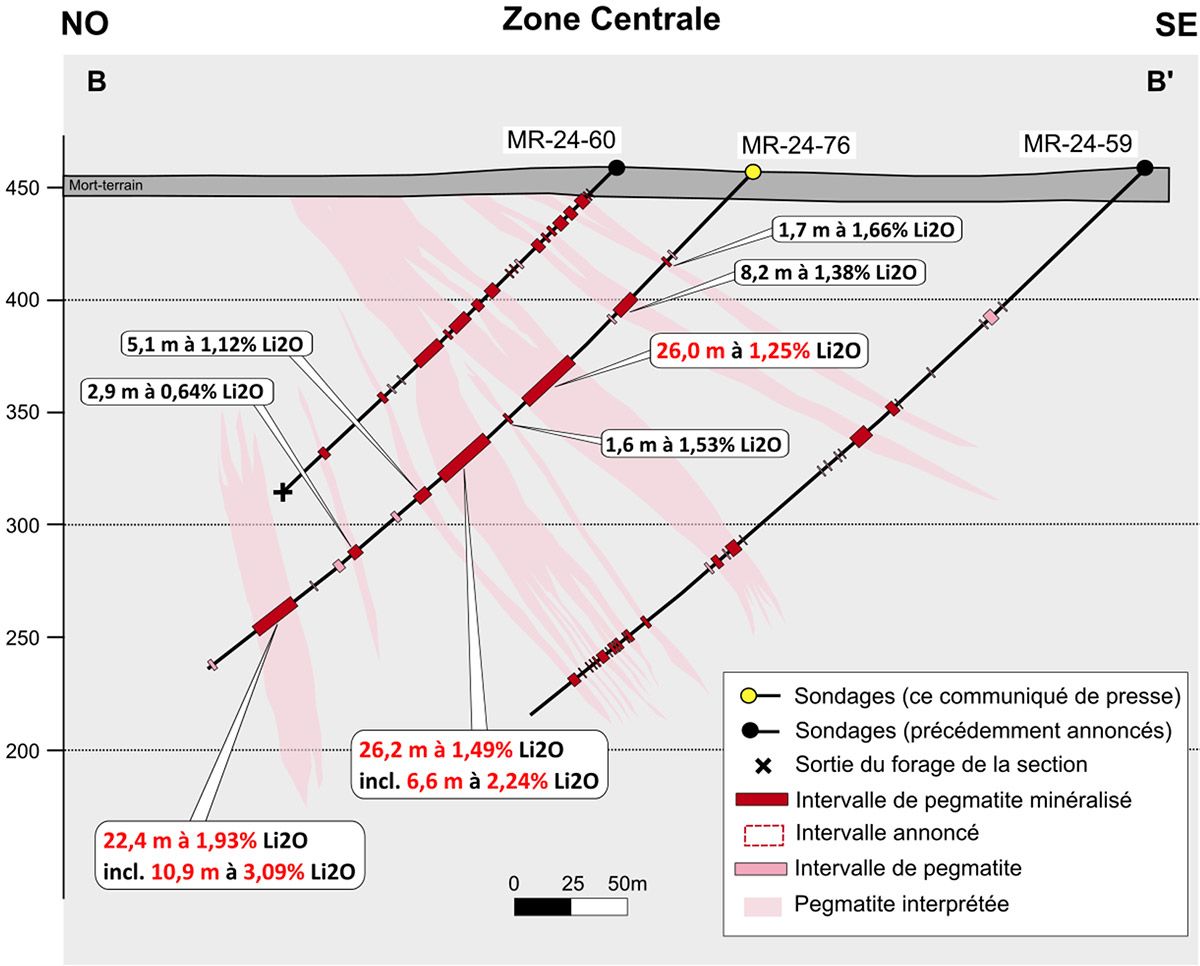 Figure 4 : Sections transversales B à B’