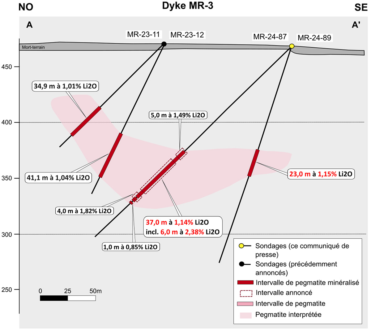 Figure 2 : Coupe transversale A à A'